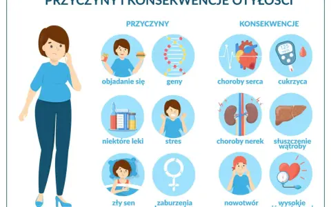 Ilustracja pokazuje przyczyny i konsekwencje nadwagi i otyłości: objadanie się, geny, stres, złe leki, zły sen, zaburzenia hormonalne prowadzą do chorób serca, cukrzycy, chorób nerek, stłuszczenia wątroby, nowotworów i wysokiego ciśnienia krwi.