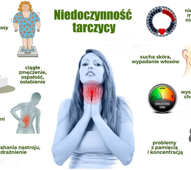Niedoczynność tarczycy objawy: przyrost masy ciała, zmęczenie, bóle mięśni, wahania nastroju, sucha skóra, wypadanie włosów, problemy z pamięcią.